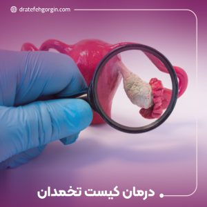 درمان کیست تخمدان