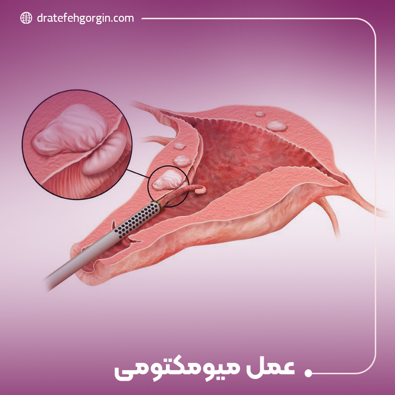 عمل میومکتومی
