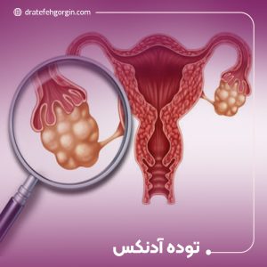 توده آدنکس