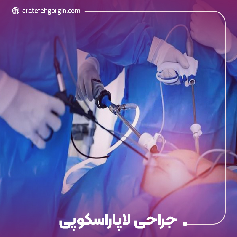 جراحی لاپاراسکوپی