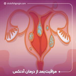 مراقبت‌های پس از درمان توده آدنکس