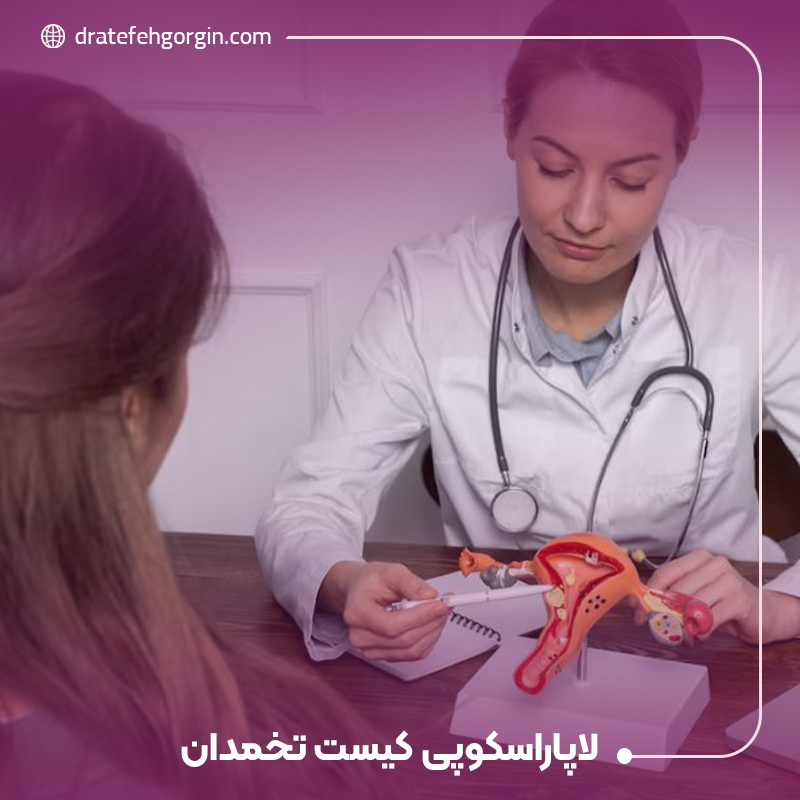 لاپاراسکوپی کیست تخمدان