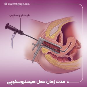 عمل هیستروسکوپی چقدر طول می کشد؟
